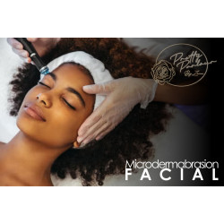 Microdermabrasion Microdermabrasion